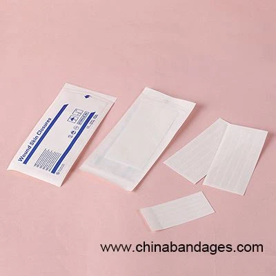 wound closure strip